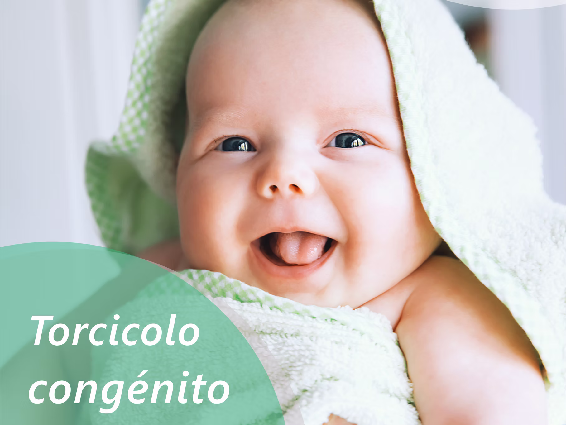 torcicolo congénito